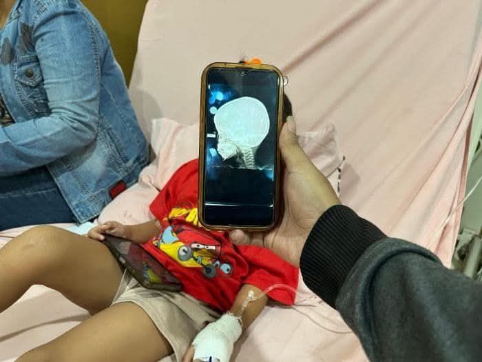 Begini Kondisi Bocah Yang Matanya Tertembus Peluru Di Belawan